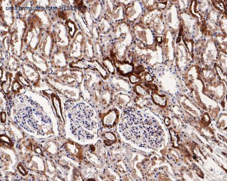 HUABIO HA500105 image 2