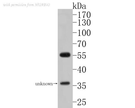 HUABIO HA500120 image 1