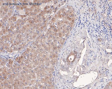 HUABIO HA500120 image 3