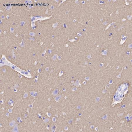 HUABIO HA500136 image 2