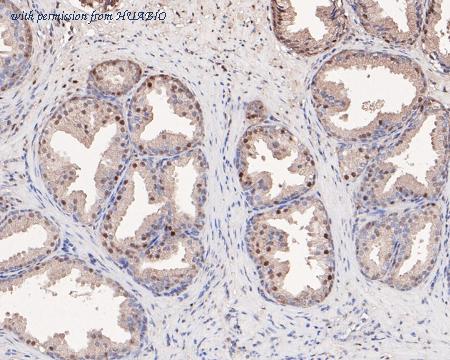 HUABIO HA500138 image 3