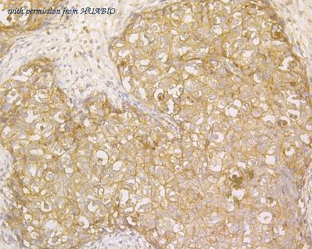 HUABIO HA500168 image 2