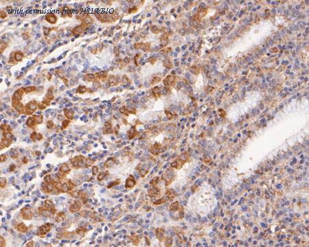 HUABIO HA500178 image 1