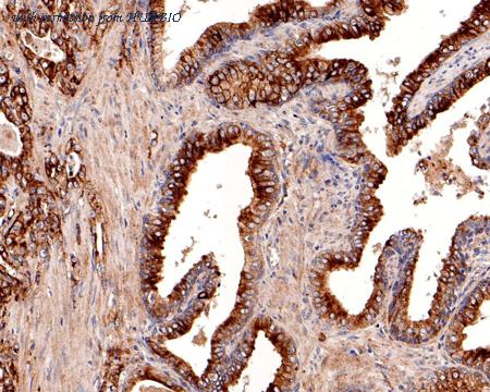 HUABIO HA500190 image 2