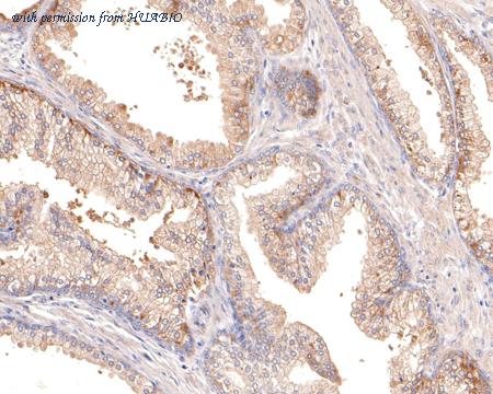 HUABIO HA500284 image 1