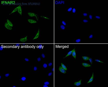 HUABIO HA500284 image 2