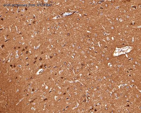 HUABIO HA500346 image 3