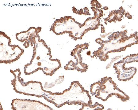 HUABIO HA500378 image 1