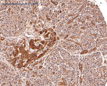 HUABIO HA500383 image 2