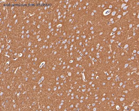 HUABIO HA500392 image 3