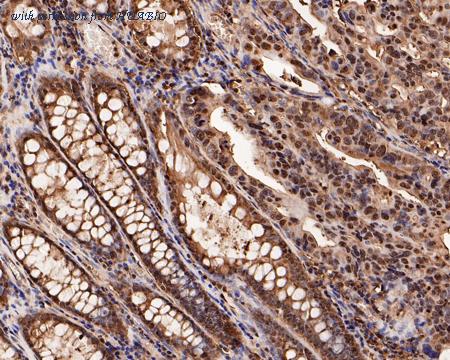 HUABIO HA500394 image 2