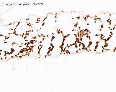 HUABIO HA500435 image 2