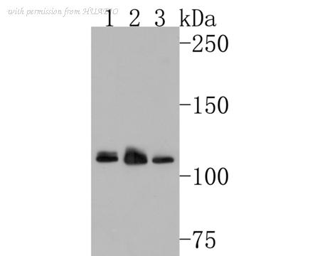 HUABIO HA500485 image 1