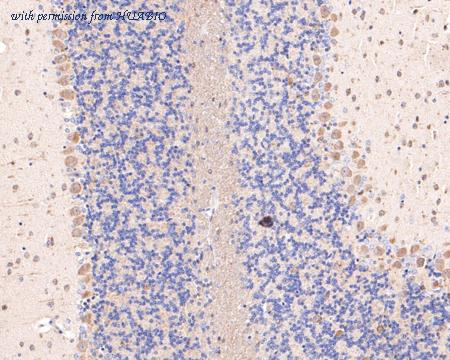 HUABIO HA500500 image 2