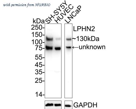 HUABIO HA500555 image 1