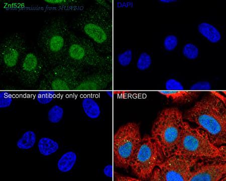 HUABIO HA500578 image 1