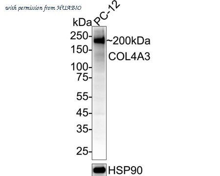 HUABIO HA500591 image 1
