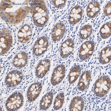 HUABIO HA500593 image 2