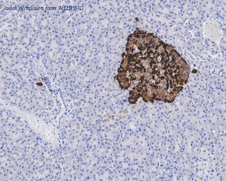 HUABIO HA600016 image 2