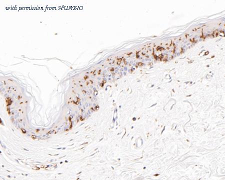 HUABIO HA600031 image 1