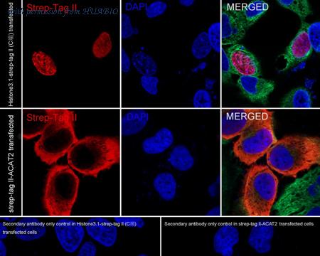 HUABIO HA600038-50UL image 2