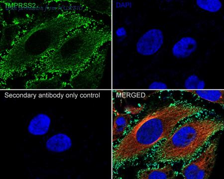 HUABIO HA600057 image 2