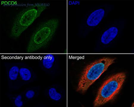 HUABIO HA600092 image 2