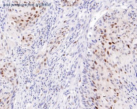 HUABIO HA601018 image 1