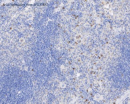 HUABIO HA601019 image 3