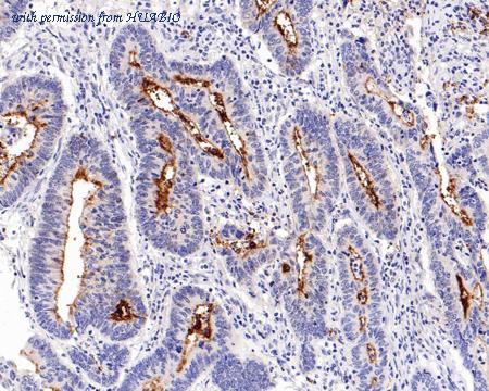 HUABIO HA601062 image 3