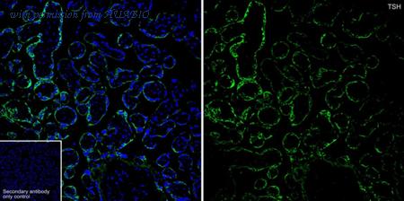 HUABIO HA601072 image 3