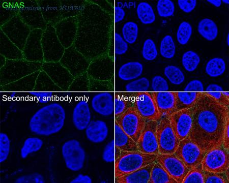 HUABIO HA601075 image 2