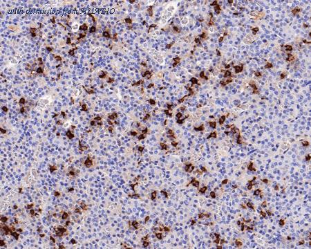 HUABIO HA601113 image 2