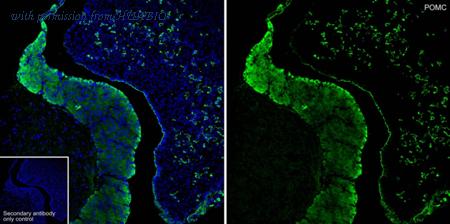 HUABIO HA601113 image 3