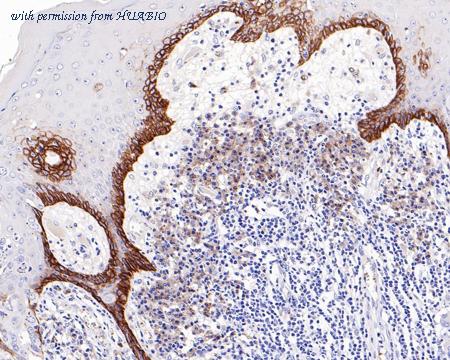 HUABIO HA601125 image 2