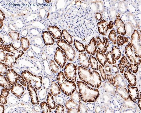 HUABIO HA601125 image 3