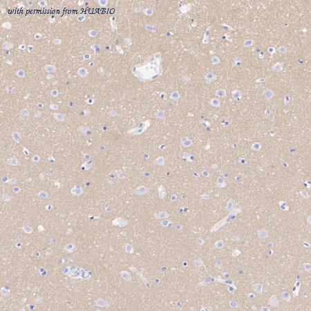 HUABIO HA601126 image 3