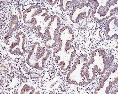 HUABIO HA601128 image 2