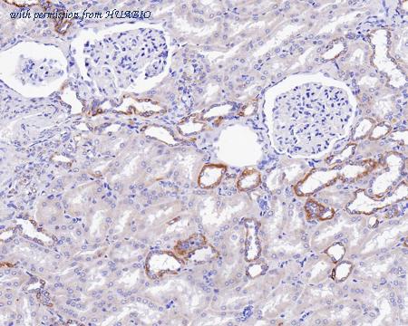 HUABIO HA601128 image 3