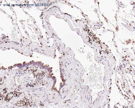 HUABIO HA601129 image 3