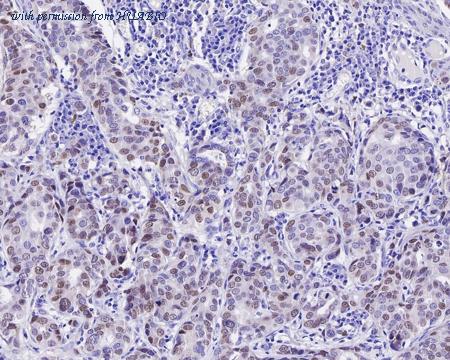 HUABIO HA601132 image 2