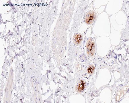 HUABIO HA601136 image 1