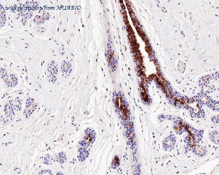 HUABIO HA601136 image 2