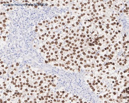 HUABIO HA601168 image 2