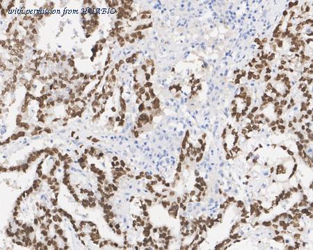 HUABIO HA601168 image 3