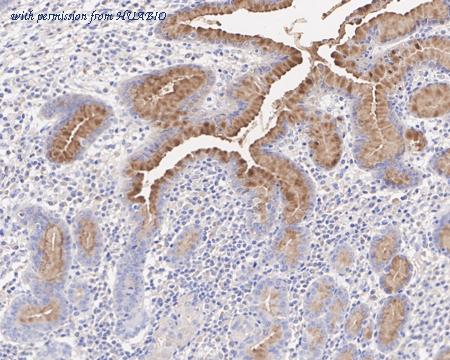 HUABIO HA601182 image 1