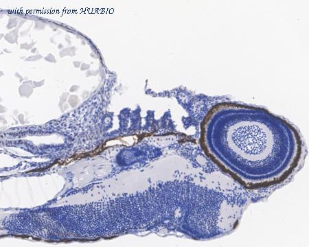 HUABIO HA601183 image 3