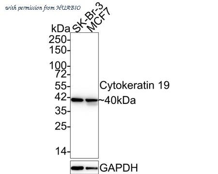 HUABIO HA601258 image 1