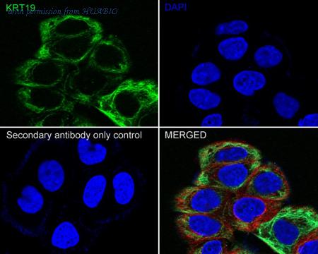 HUABIO HA601258 image 3