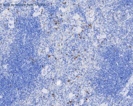 HUABIO HA601262 image 3